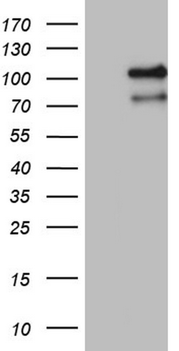 BRIT1 (MCPH1) antibody