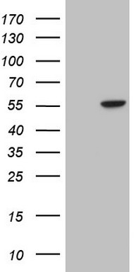 Integrin Linked Kinase (ILK) antibody
