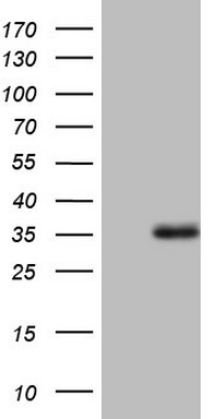 Ocular development associated gene (GATAD1) antibody