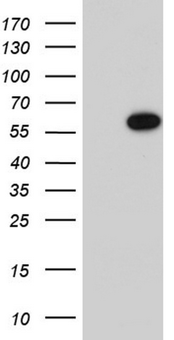 PRAK (MAPKAPK5) antibody
