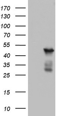 BFSP2 Antibody