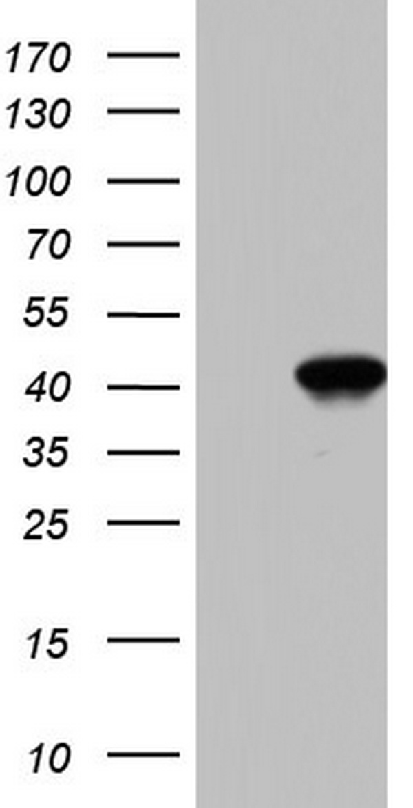 BFSP2 Antibody