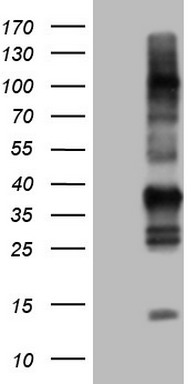 TACC2 Antibody