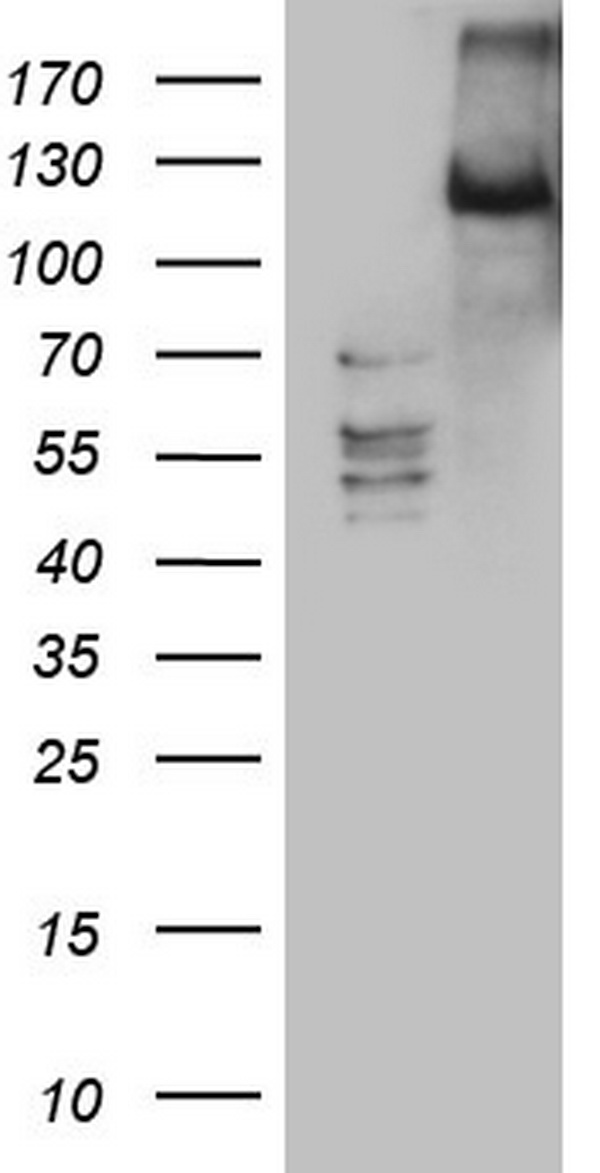 LATS2 antibody