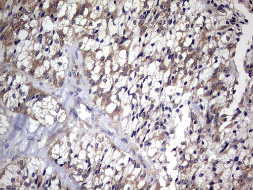 Macrophage Inflammatory Protein 3 beta Antibody