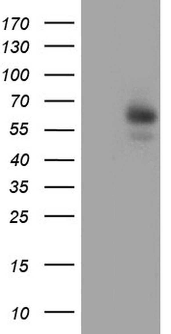 Pancreatic alpha amylase (AMY2A) antibody