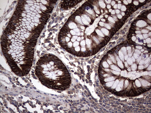 Macrophage Inflammatory Protein 3 beta Antibody