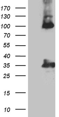 Calretinin (CALB2) antibody