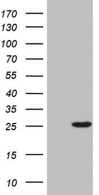 SP17 (SPA17) antibody
