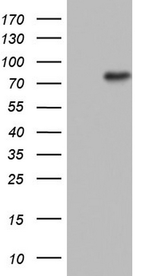 N4BP2L2 antibody