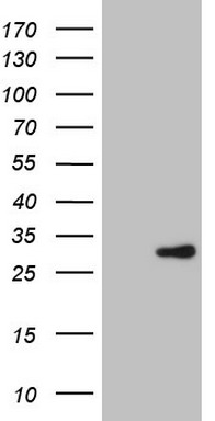 XPD (ERCC2) antibody