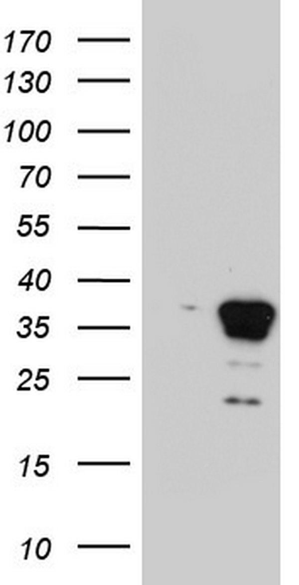 C10orf63 (ENKUR) antibody