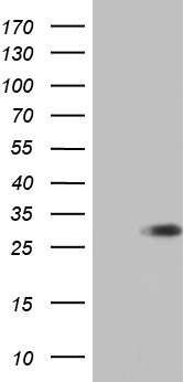 C10orf63 (ENKUR) antibody