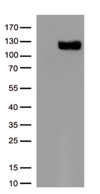 Angiotensin Converting Enzyme 2 Antibody