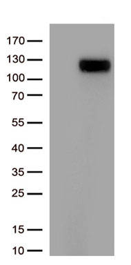 Angiotensin Converting Enzyme 2 Antibody