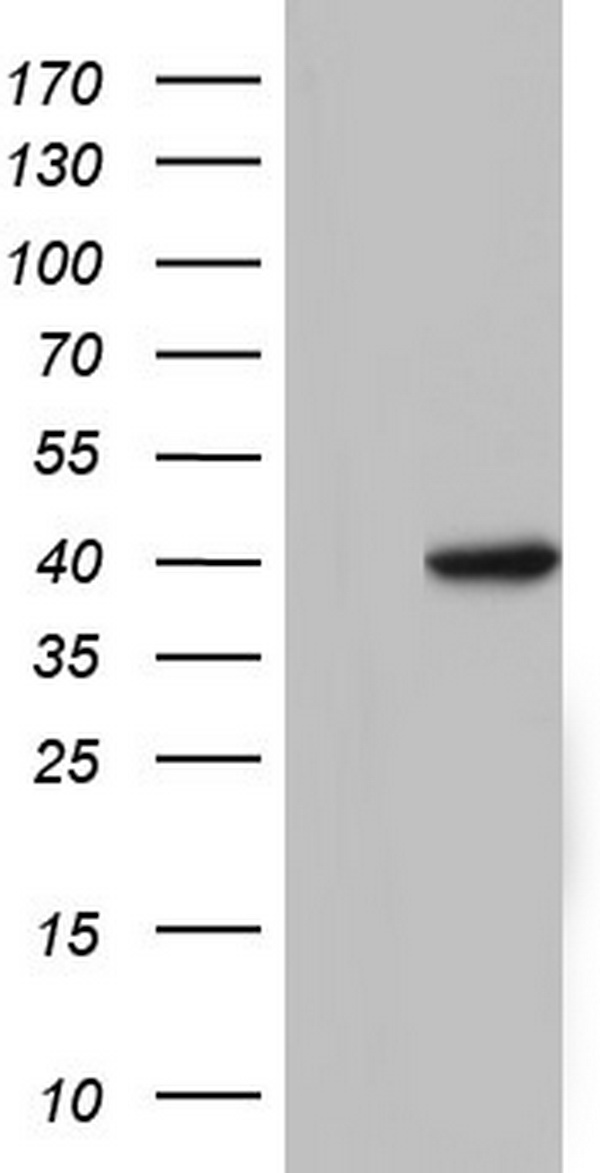TFB1M Antibody