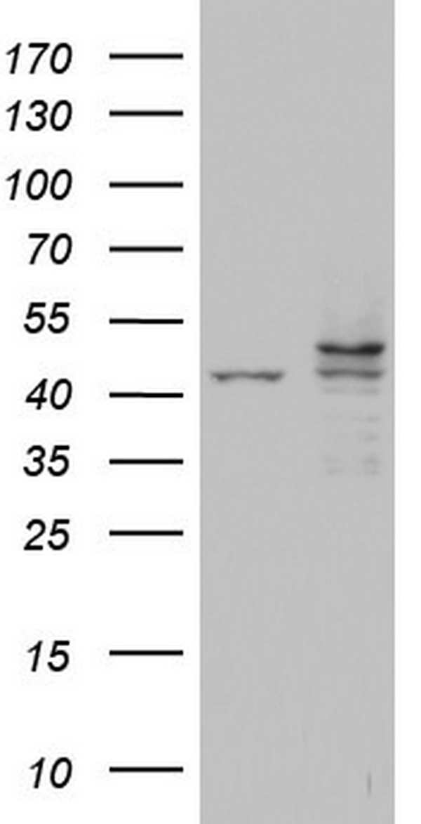 CK1 epsilon (CSNK1E) antibody