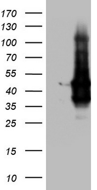 TACC2 antibody
