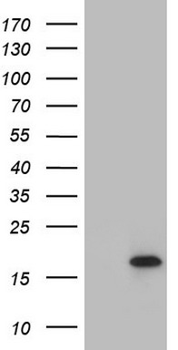 UBE2B antibody