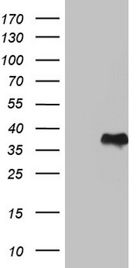 GBA antibody