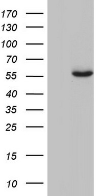 GBA antibody