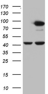 PLOD2 antibody
