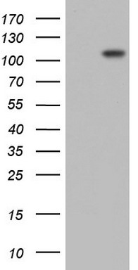 PLOD2 antibody