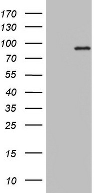 Calcium independent Phospholipase A2 Antibody