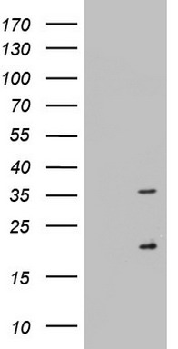 Nogo B receptor (NUS1) antibody