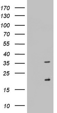 Nogo B receptor Antibody