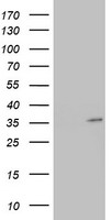 HADHSC (HADH) antibody