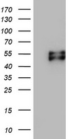 Macrophage Scavenger Receptor I (MSR1) antibody