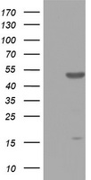 ZNF385B antibody