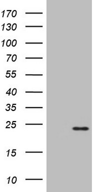 KRAS antibody