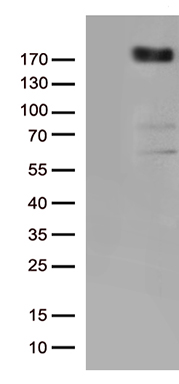 VEGF Receptor 2 (KDR) antibody