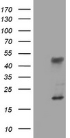 TET1 Antibody