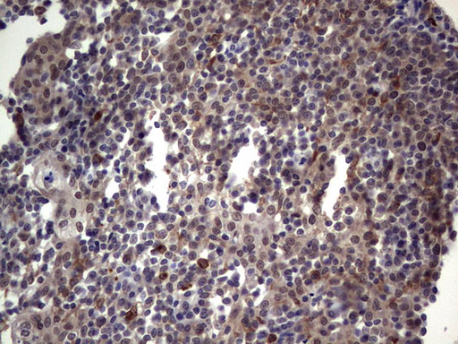 TET1 Antibody