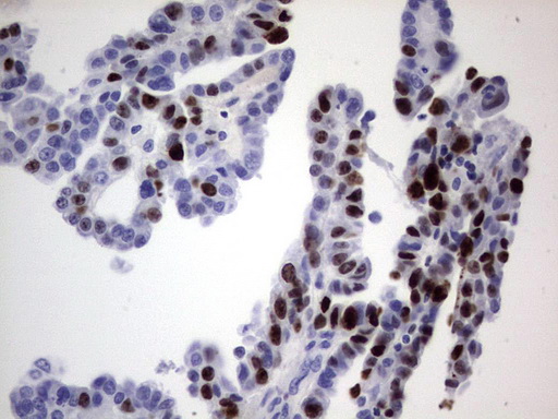 Ki67 (MKI67) antibody