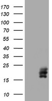 hCG beta (CGB3) antibody