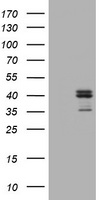 CD23 (FCER2) antibody