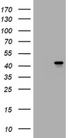 MUC16 antibody