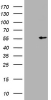 Vimentin (VIM) antibody