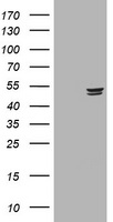 Thymidine Phosphorylase (TYMP) antibody