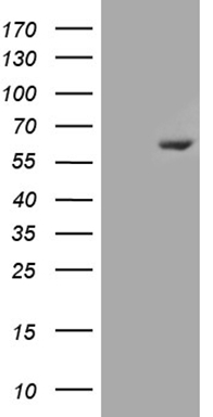 Estrogen Receptor beta (ESR2) antibody