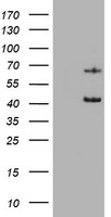 Cytokeratin 5 (KRT5) antibody