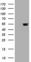 Thymidine Phosphorylase (TYMP) antibody