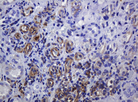 SOAT 2 (SOAT2) antibody