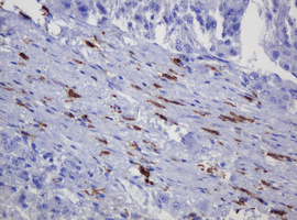 SOAT 2 Antibody