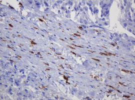 SOAT 2 (SOAT2) antibody