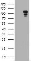 Progesterone Receptor (PGR) antibody